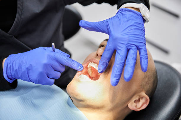 Best Emergency Dental Care for Sports Injuries in Cumberland Hill, RI